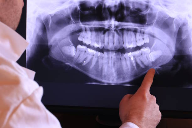 Best Walk-In Emergency Dental Services in Waverly, NE